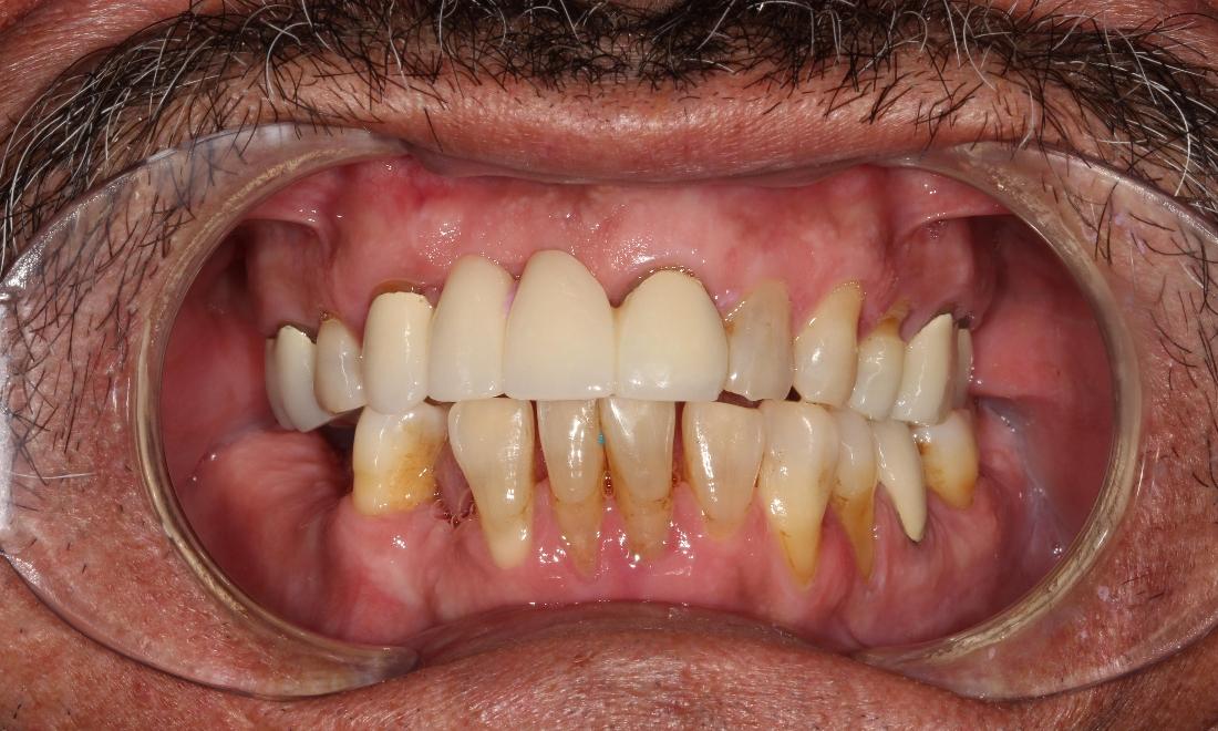 misshapen, discolored teeth farmington nm