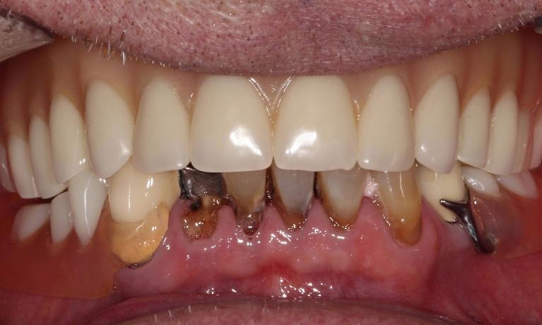 decaying teeth and gum disease farmington nm